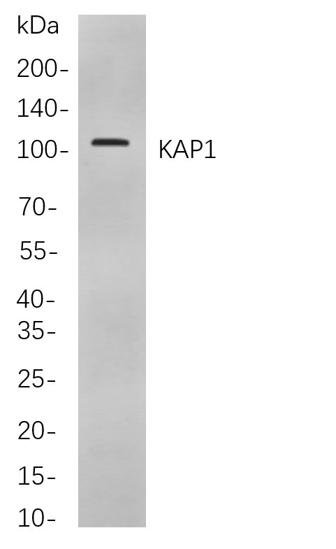 KAP1