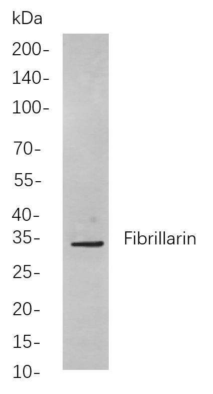 Fibrillarin