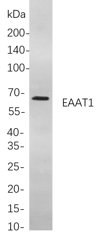 EAAT1