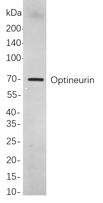 Optineurin