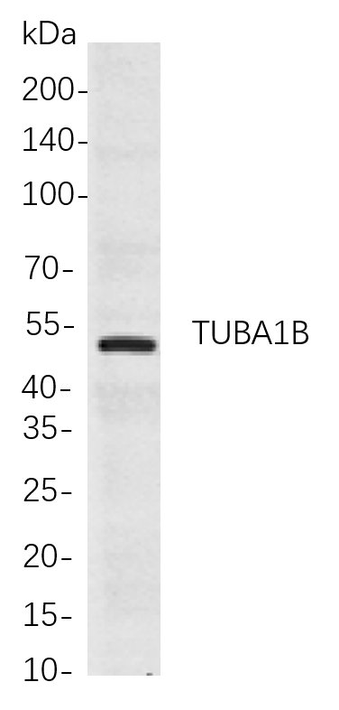 TUBA1B
