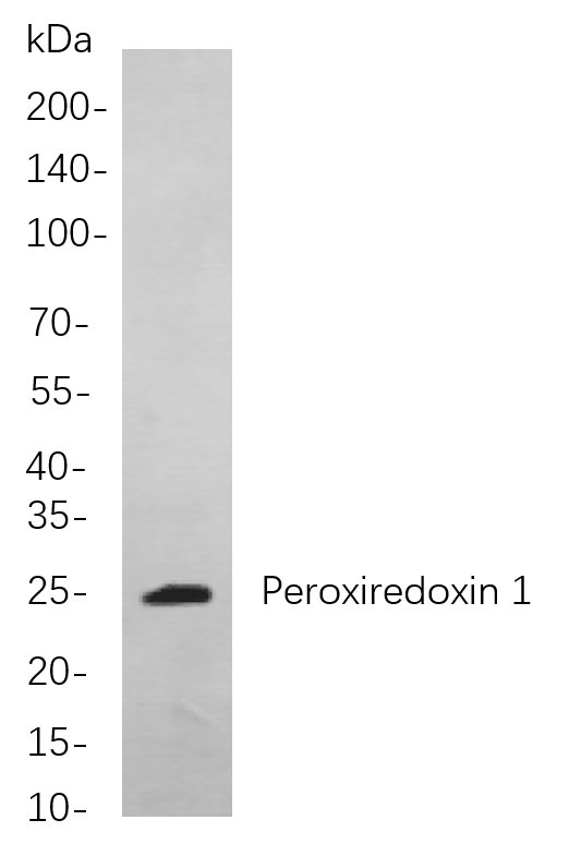 Peroxiredoxin 1