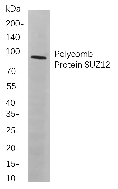 Polycomb Protein SUZ12