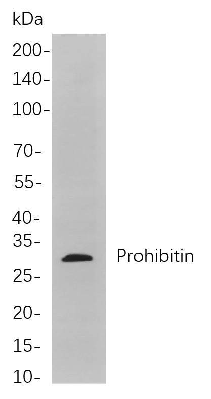 Prohibitin