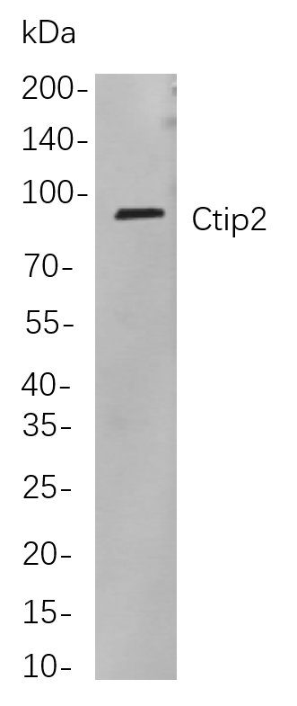 Ctip2