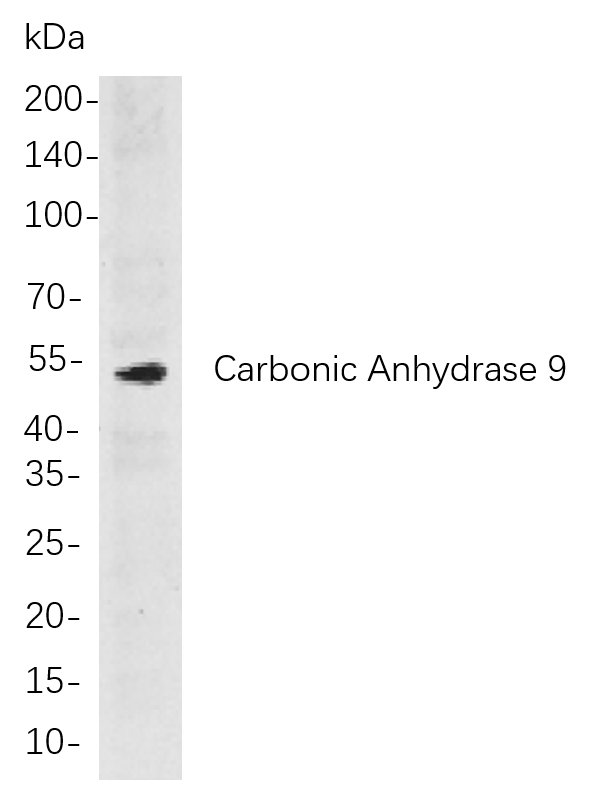 Carbonic Anhydrase 9