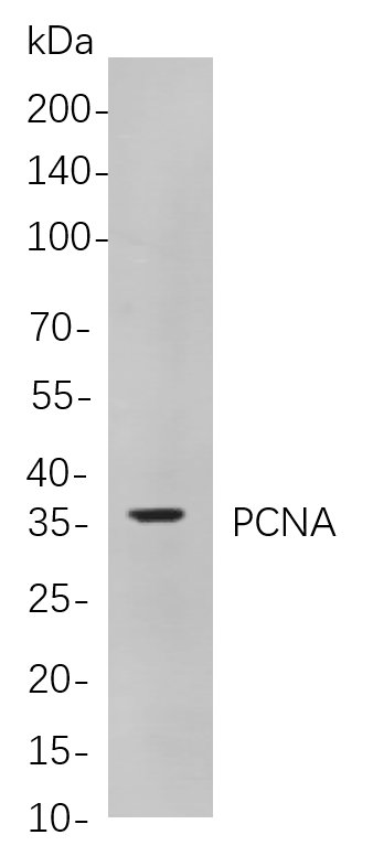 PCNA