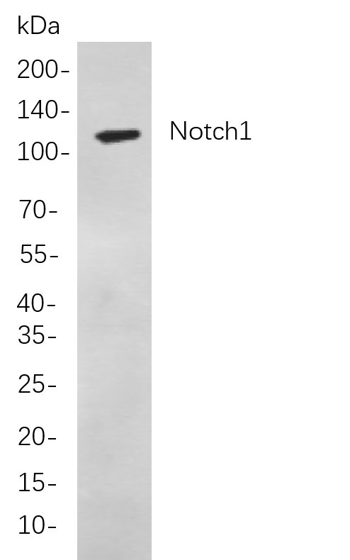 Notch1