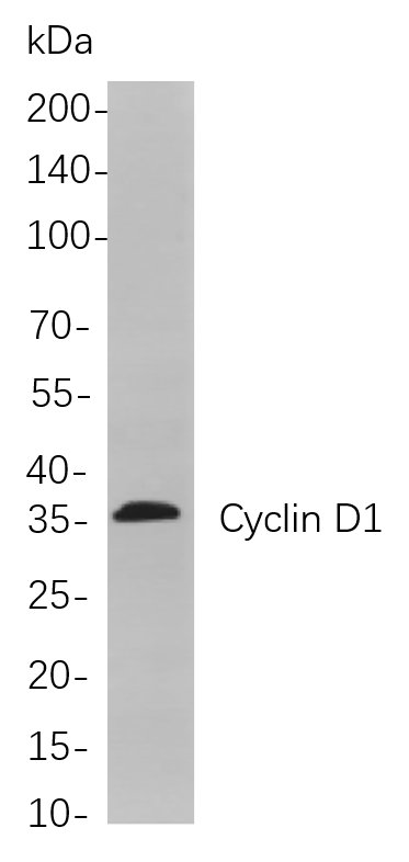 Cyclin D1