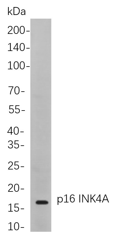 p16 INK4A