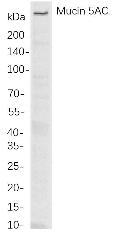 Mucin 5AC
