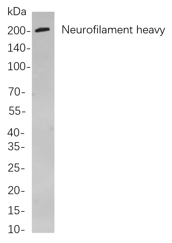 Neurofilament heavy polypeptide