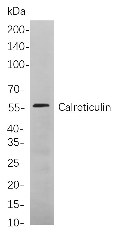 Calreticulin