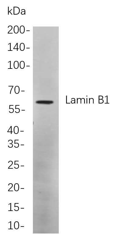 Lamin B1