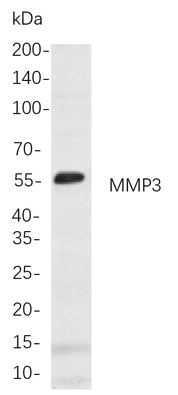 MMP3