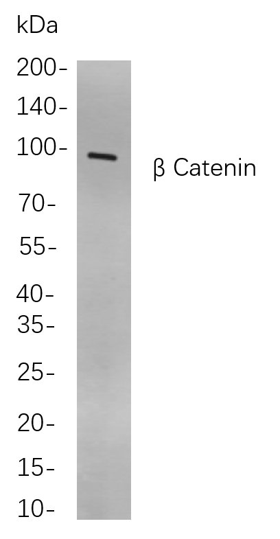 β Catenin