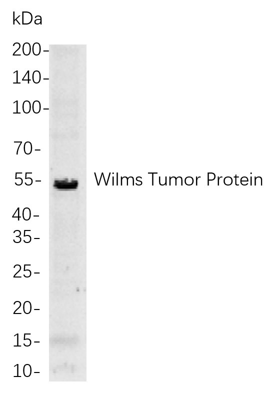 Wilms Tumor Protein