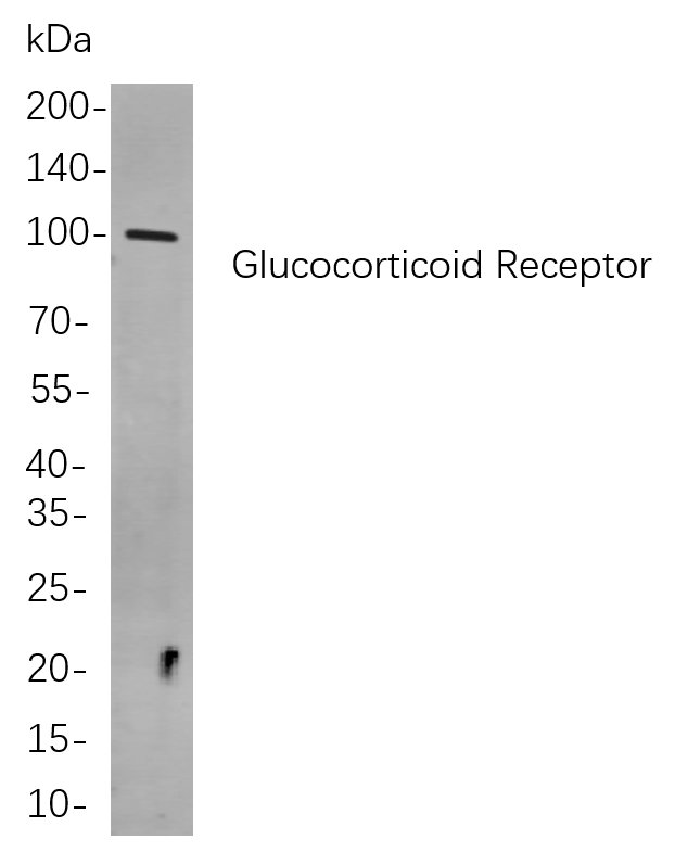 Glucocorticoid Receptor