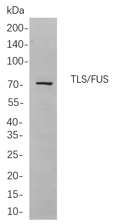 TLS/FUS