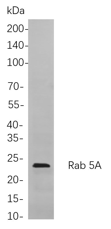Rab 5A