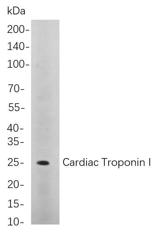 Cardiac Troponin I