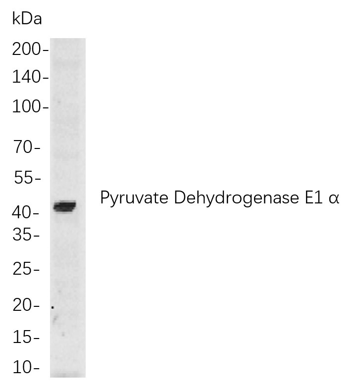 Pyruvate Dehydrogenase E1 α