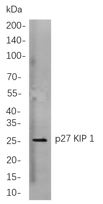 p27 KIP 1