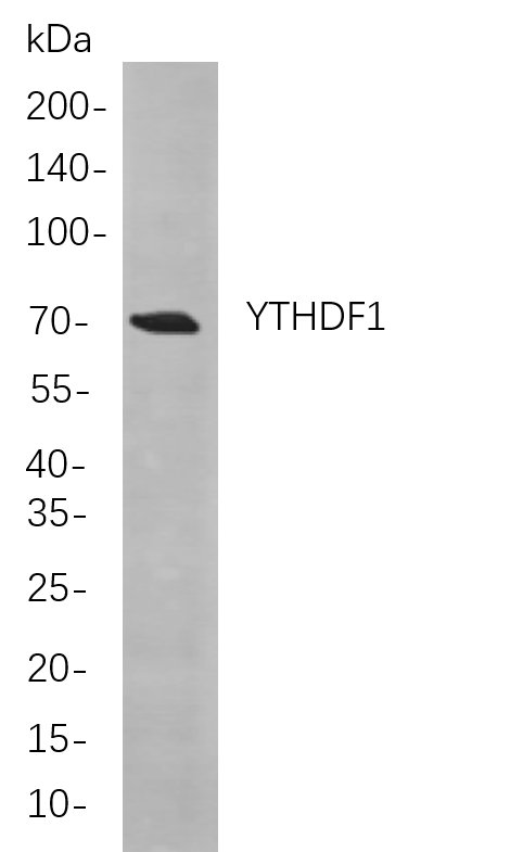 YTHDF1