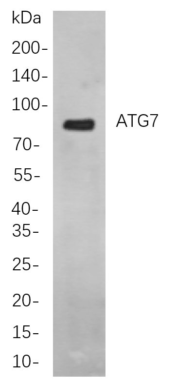 ATG7