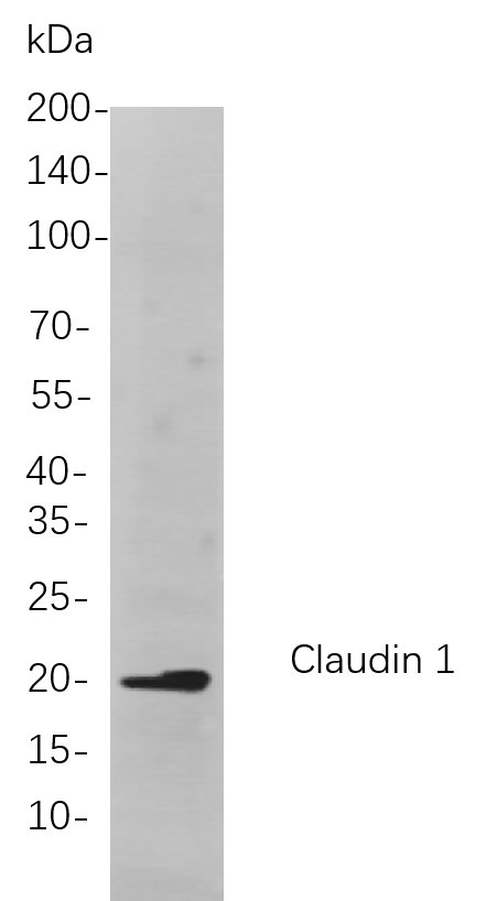 Claudin 1