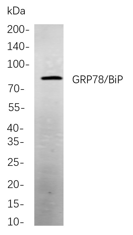 GRP78/BiP