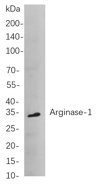 Arginase-1