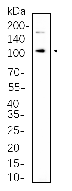 IRE1α