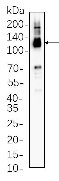 Notch2