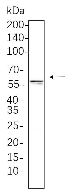 E2F-1