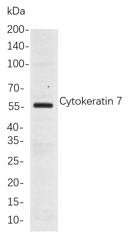 Cytokeratin 7