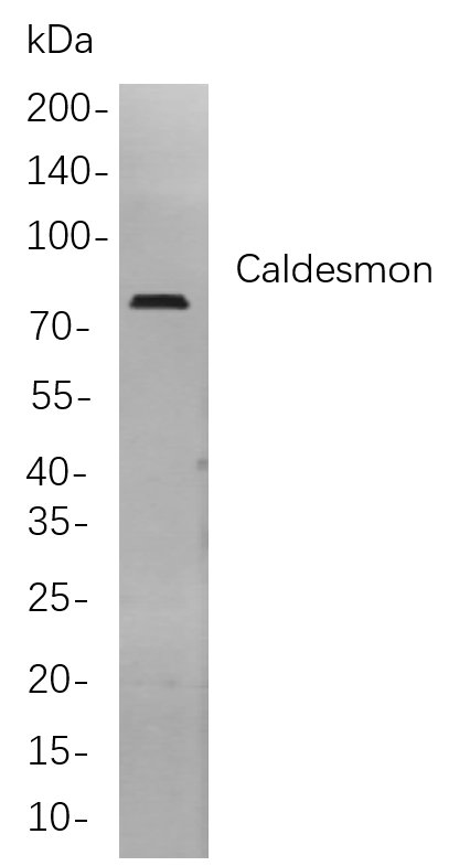 Caldesmon