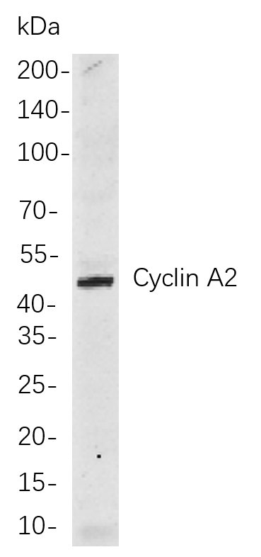 Cyclin A2