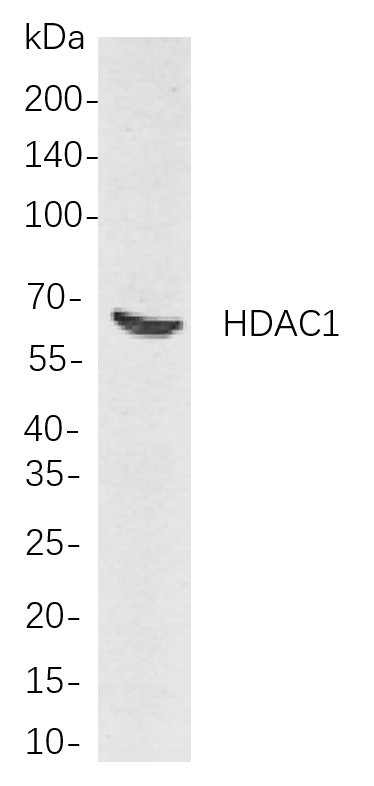 HDAC1