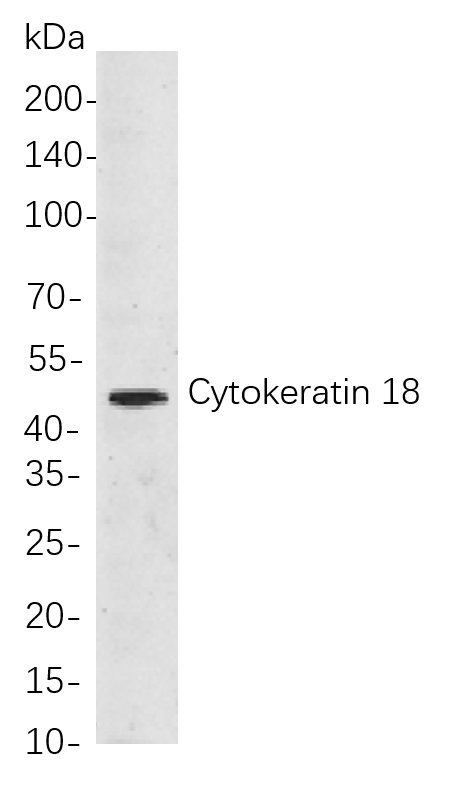 Cytokeratin 18