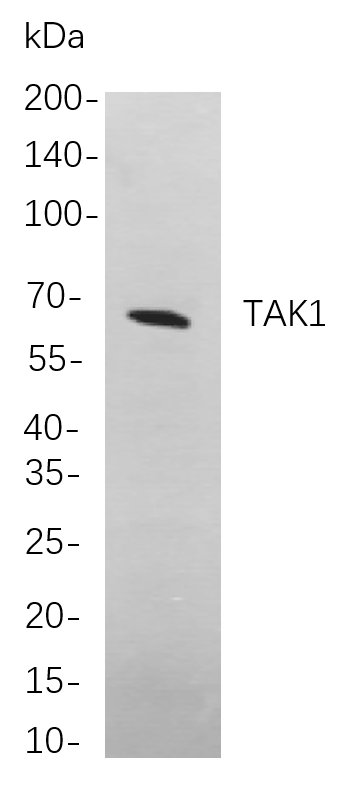 TAK1