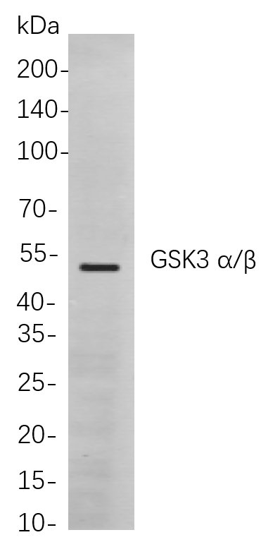 GSK3 α/β