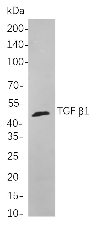 TGF β1