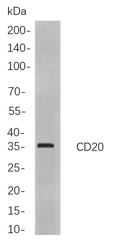 CD20
