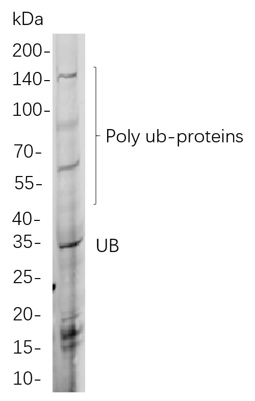 Ubiquitin K48