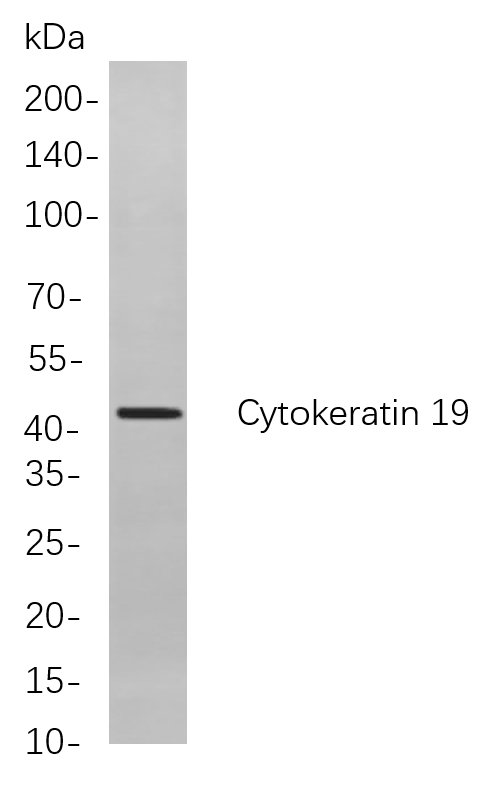 Cytokeratin 19
