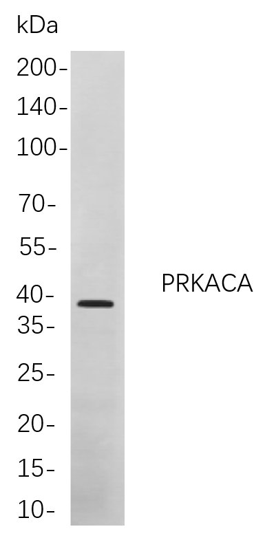 PRKACA