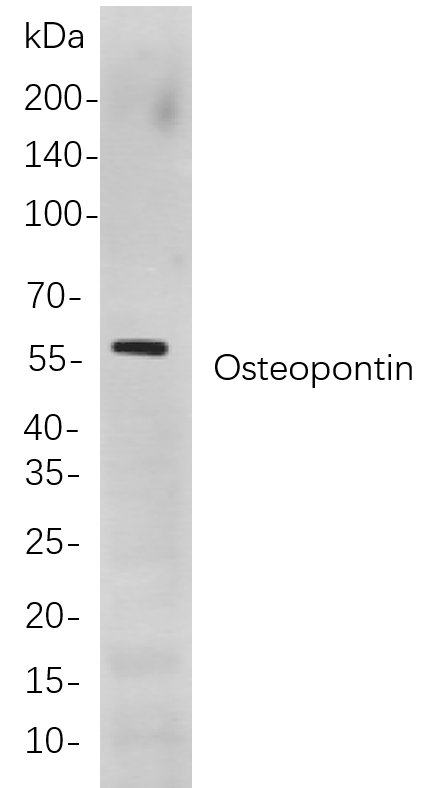 Osteopontin