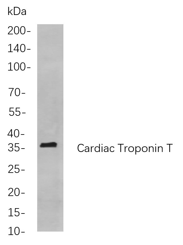 Cardiac Troponin T