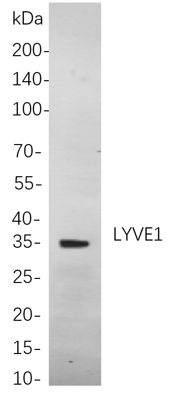 LYVE1